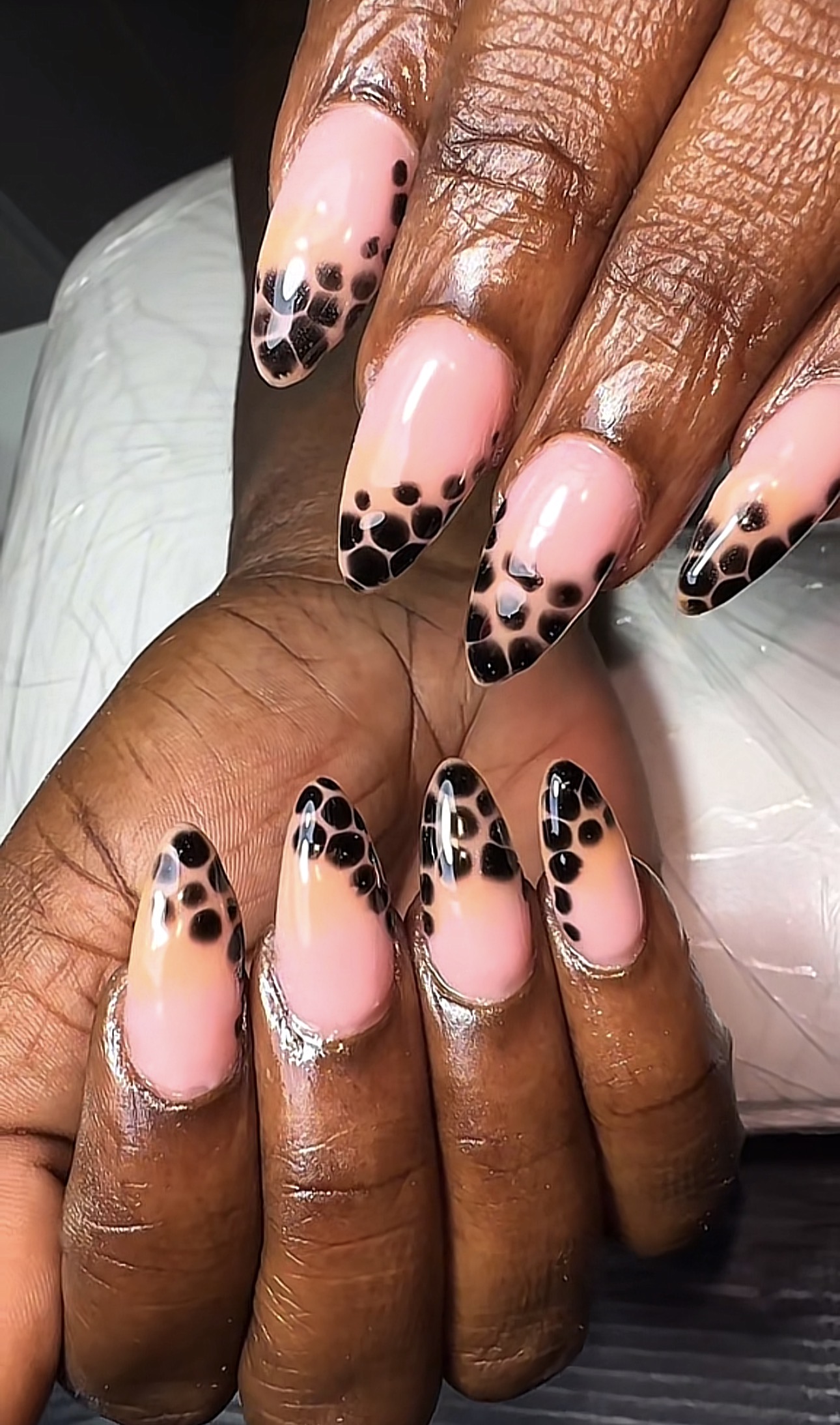 Medium Gel X