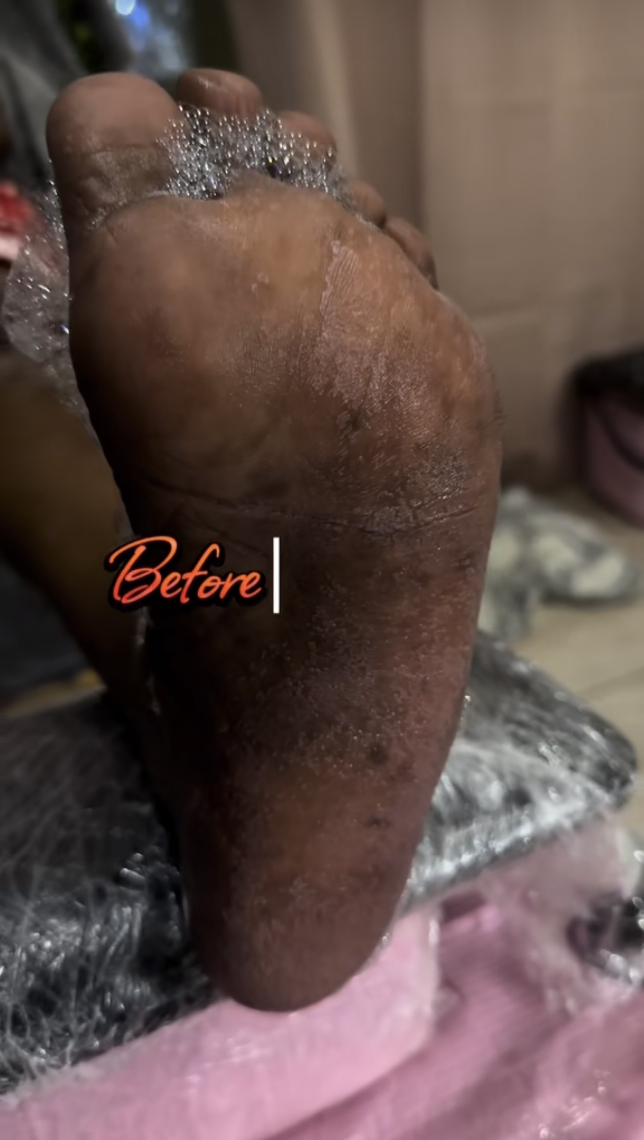 Basis Pedicure extra vuil vrouw